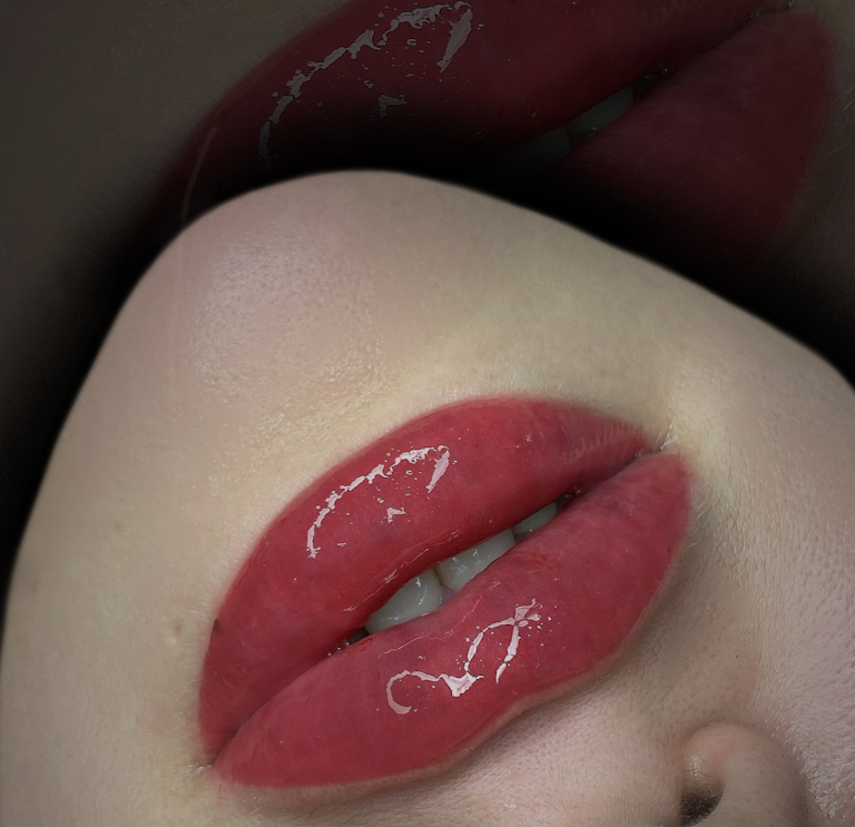 Dramatic deep rose lip enhancement result with high gloss finish